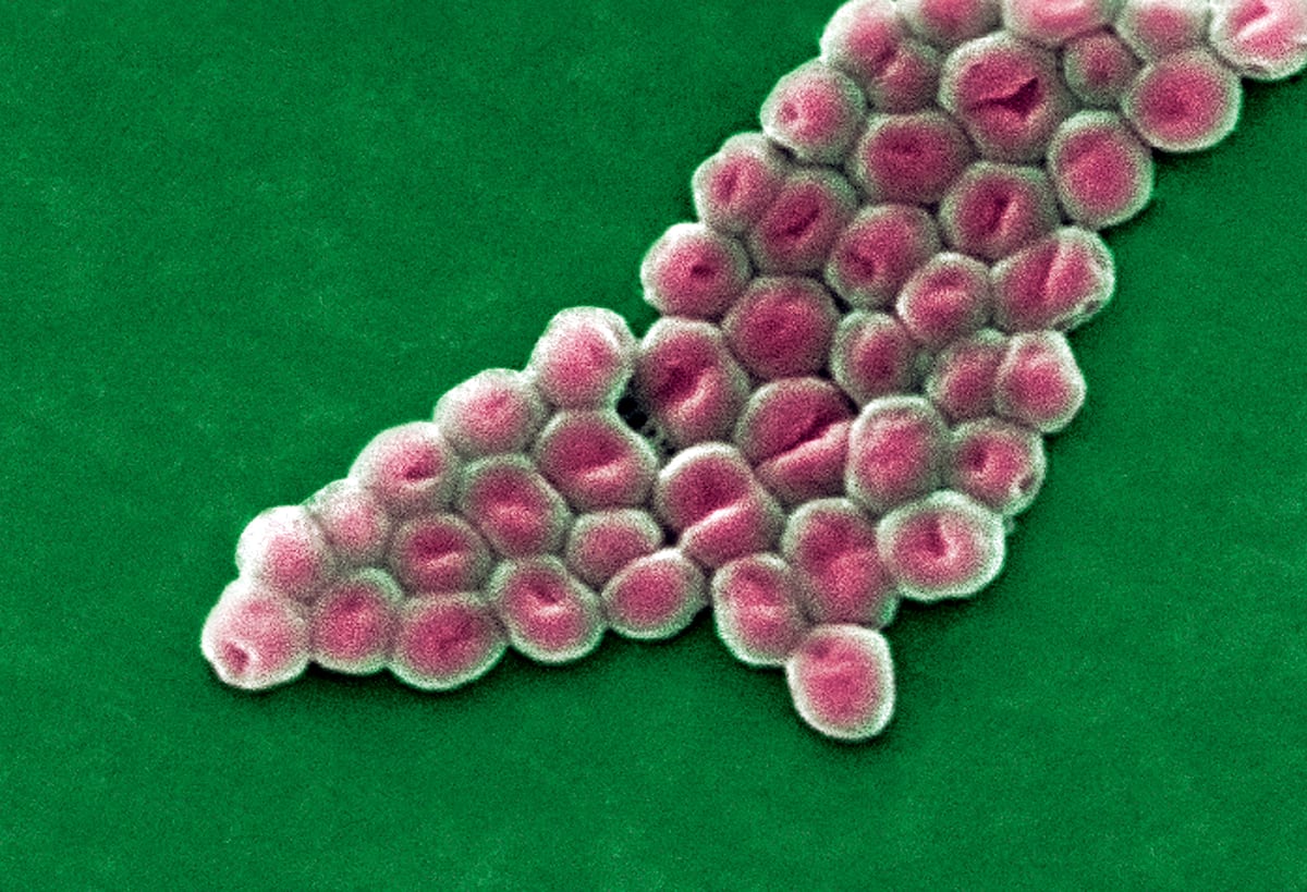 Antibiotic Resistance: The Invisible Threat of Hospital Superbugs